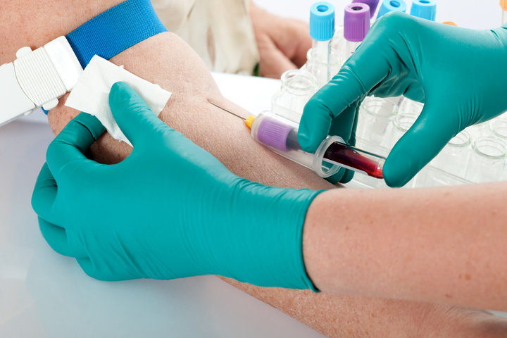 blood test